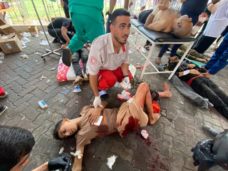 GAZA CITY, GAZA - NOVEMBER 14: (EDITORS NOTE: Image depicts graphic content) Injured Palestinians receive medical treatment at the yard of the Al-Ahli Baptist Hospital after Israel's airstrikes as Israeli army's strikes continue on its 39th day in Gaza Strip on November 14, 2023. (Photo by Montaser Alsawaf/Anadolu via Getty Images)