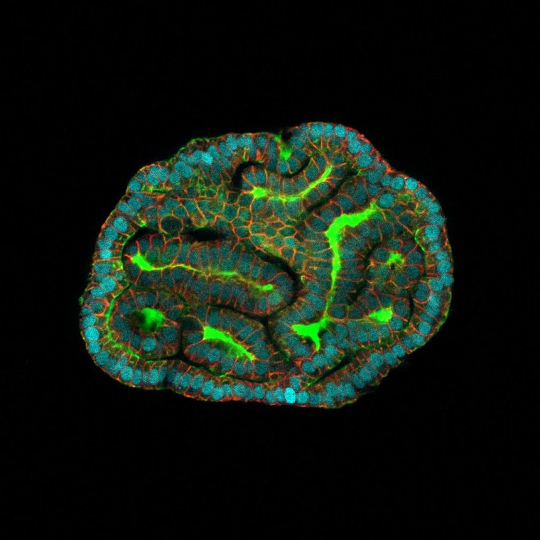 EMBARGOED TO 1600 MONDAY MARCH 4 Undated handout image issued by UCL of Kidney amniotic fluid organoids resembling renal tubules, as "mini organs" have been grown for the first time using human stem cells taken during pregnancy, potentially leading to advances in prenatal medicine. The study means human development can be observed in late pregnancy for the first time, raising the possibility of monitoring and treating congenital conditions before birth. Issue date: Monday March 4, 2024. PA Photo. See PA story SCIENCE StemCells. Photo credit should read: Giuseppe Cala/Paolo di Coppi/Mattia Gerli/PA Wire NOTE TO EDITORS: This handout photo may only be used in for editorial reporting purposes for the contemporaneous illustration of events, things or the people in the image or facts mentioned in the caption. Reuse of the picture may require further permission from the copyright holder.