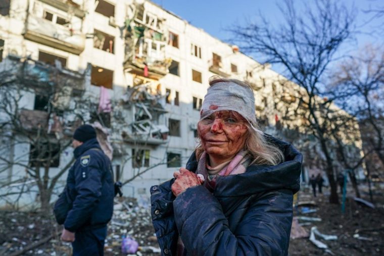 CHUHUIV, UKRAINE - FEBRUARY 24: (EDITORS NOTE: Image depicts graphic content) A wounded woman is seen after an airstrike damaged an apartment complex in city of Chuhuiv, Kharkiv Oblast, Ukraine on February 24, 2022. (Photo by Wolfgang Schwan/Anadolu Agency via Getty Images) *** BESTPIX ***