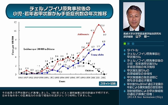 甲状腺がん手術症例数の年次推移