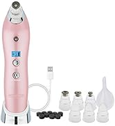 Michael Todd Beauty Sonic Refresher Patented Wet/Dry Sonic Microdermabrasion & Pore Extraction Sy...