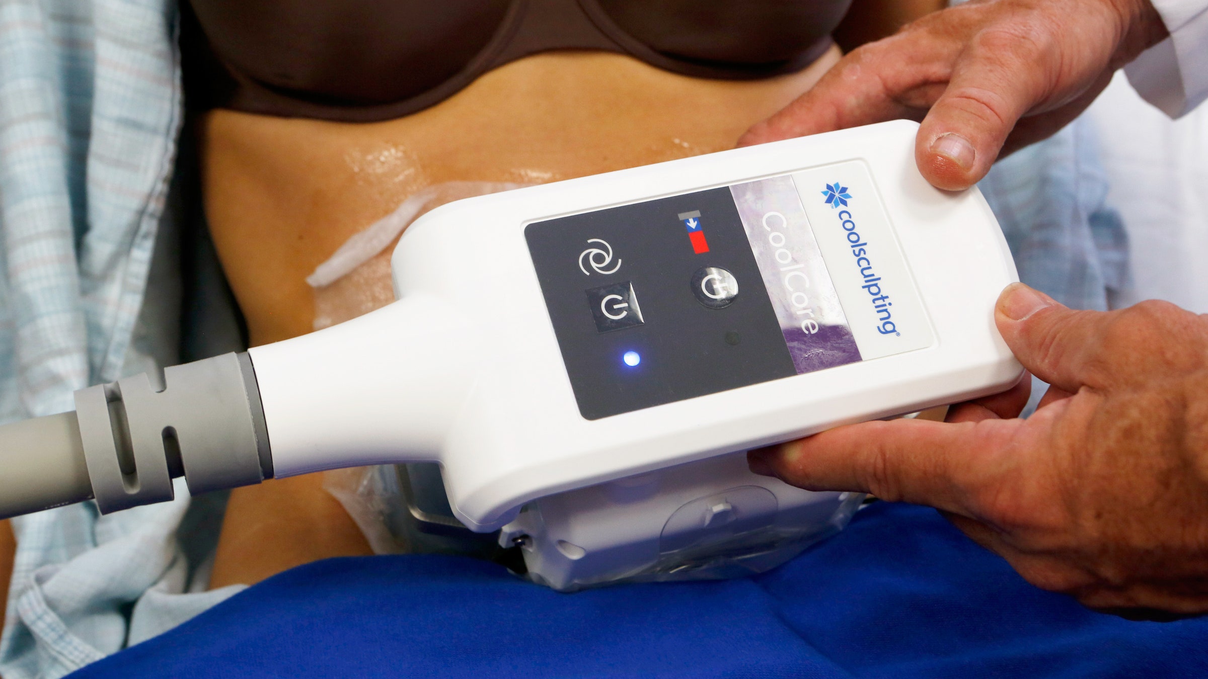 Woman gets noninvasive CoolSculpting treatment