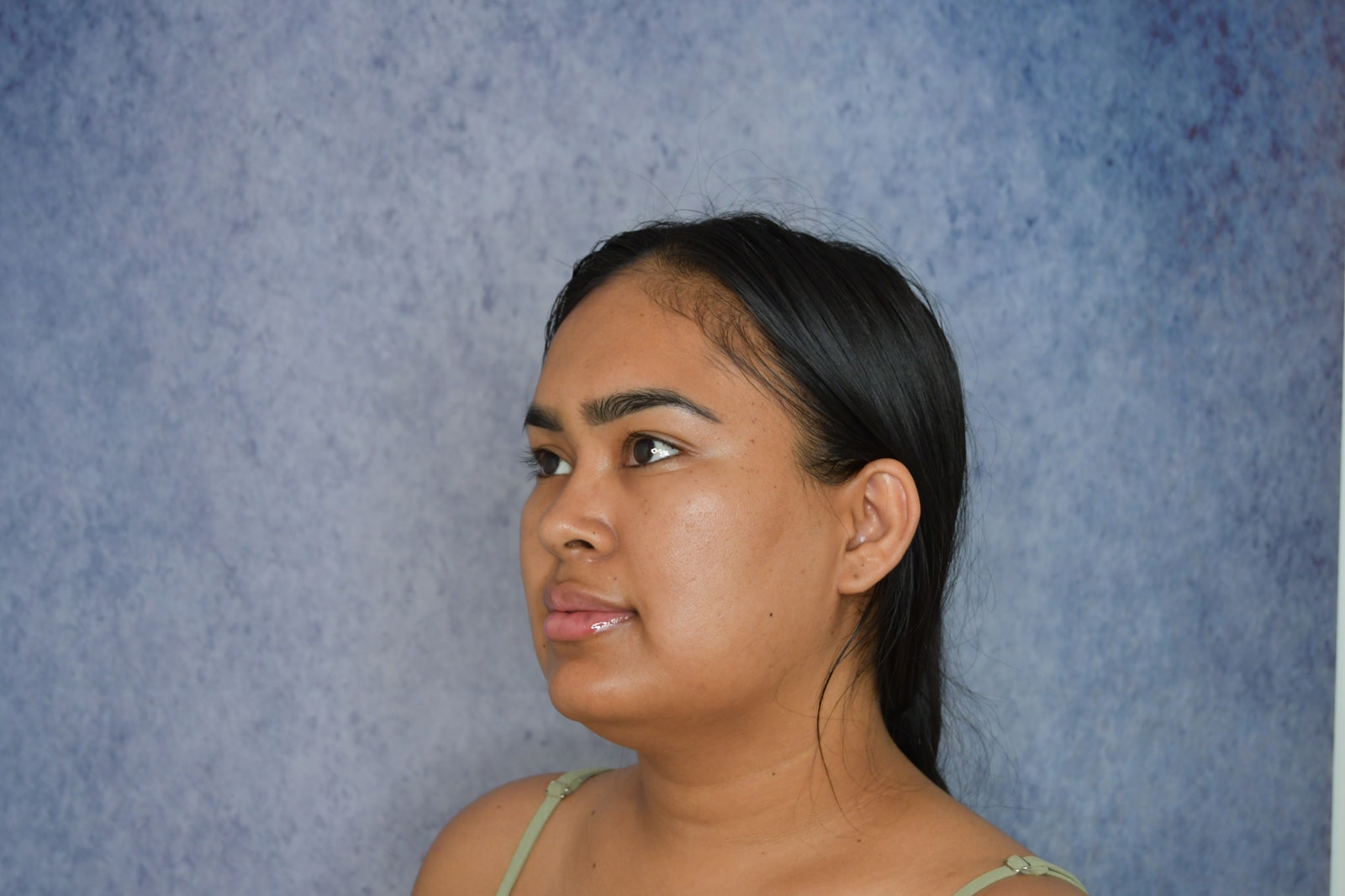 A women before jawline liposuction. She is shown from the side against a marbleized blue background