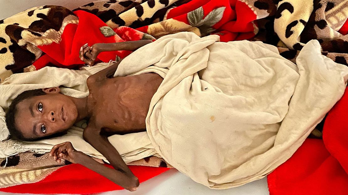 Seven-year-old Latebrahan lies on a gurney at Axum University Teaching and Referral Hospital, where she's being treated for malnourishment.