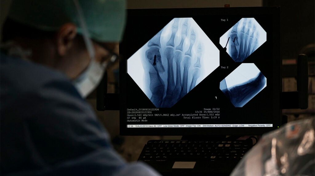 A screen showing medical imagery of a person's foot before surgery.-2