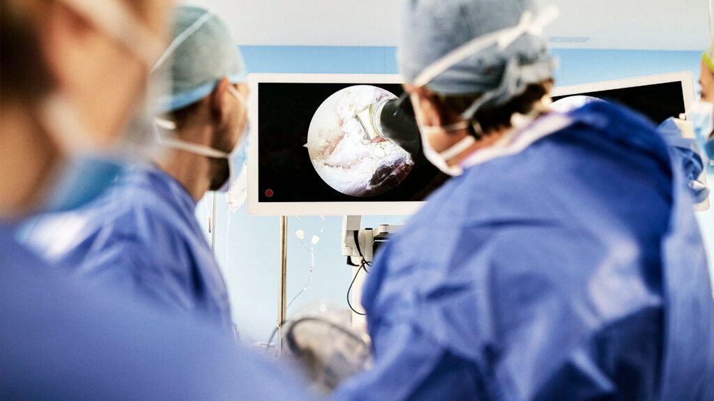 Two surgeons looking at a monitor during VATS lung surgery-1