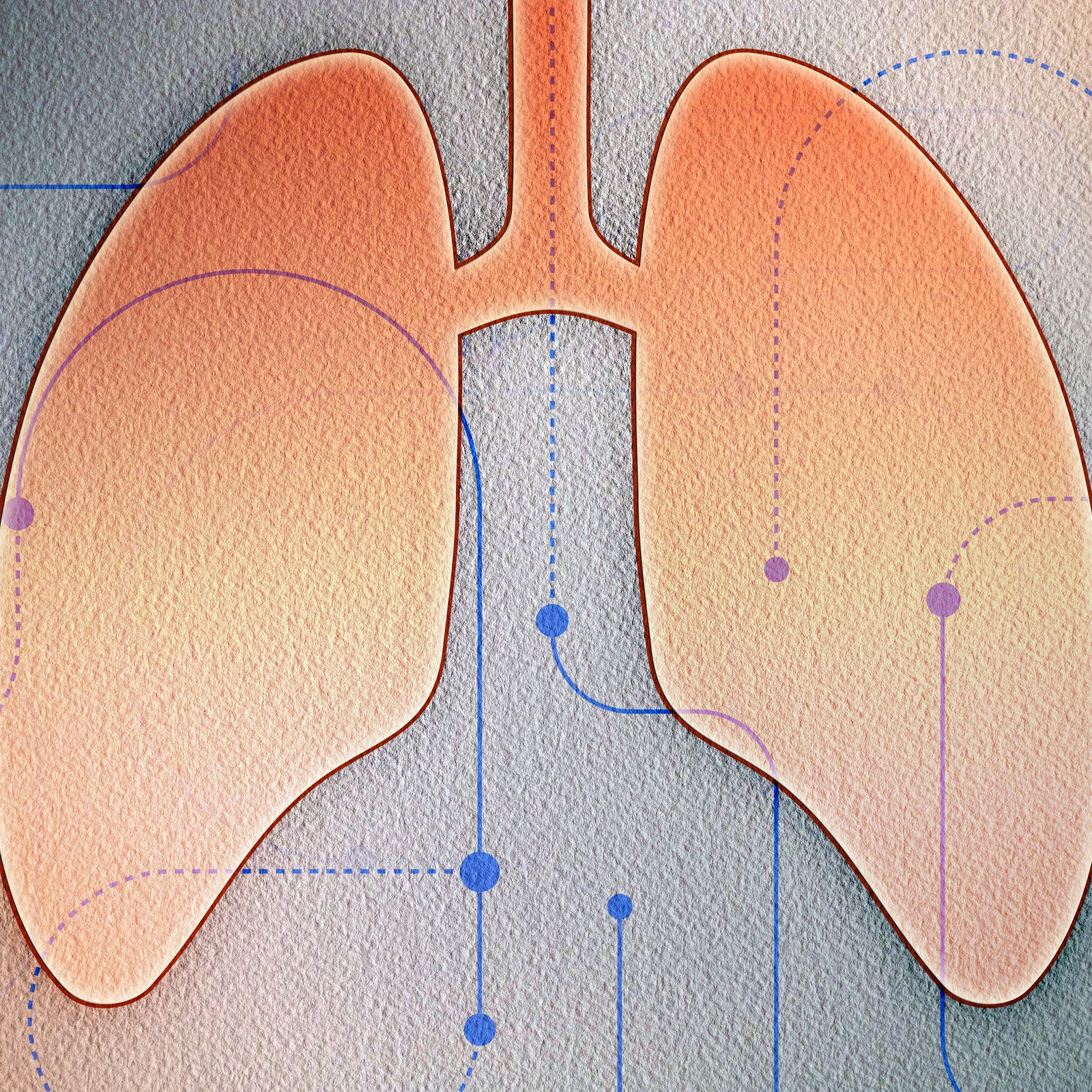 5 Signs of Lung Cancer Even Nonsmokers Need to Know