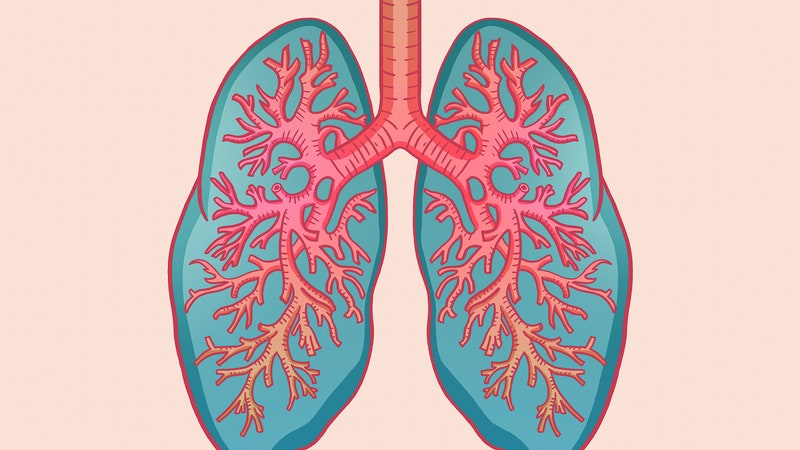 Walking Pneumonia Is on the Rise. Here Are the Symptoms to Look Out For