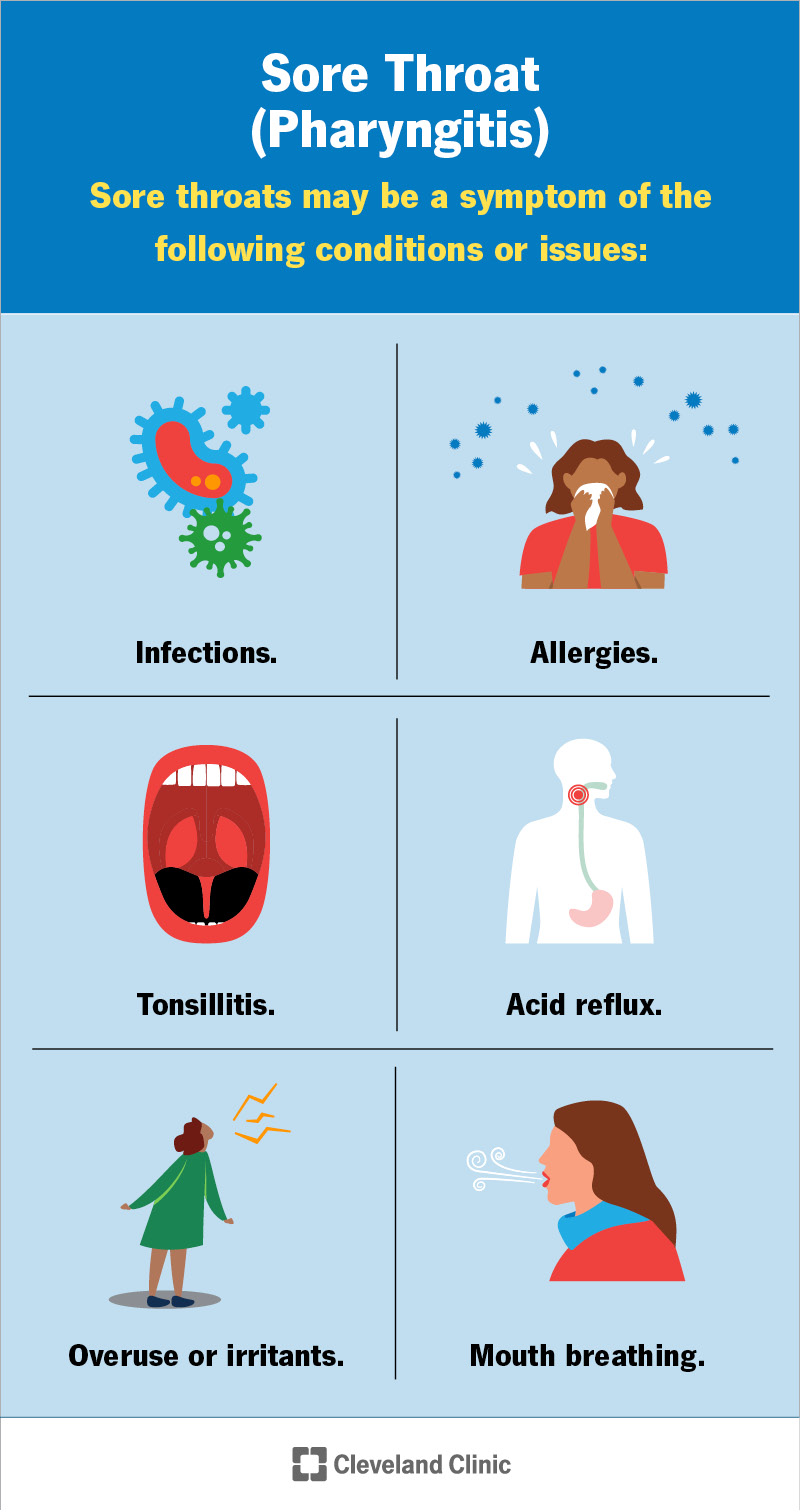 Conditions or issues that can cause a sore throat (pharyngitis)