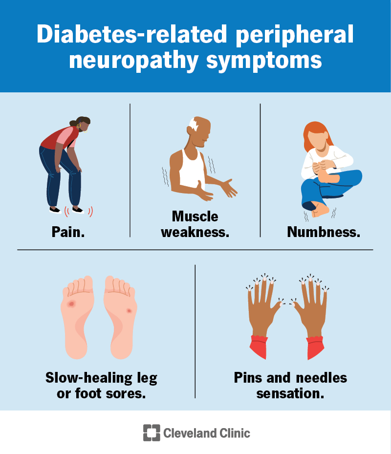 Symptoms of diabetes-related peripheral neuropathy include numbness, pain, muscle weakness, slow-healing foot sores and more