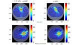 Dose distributions for pancreatic radiotherapy