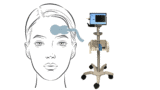 Crainio set-up for brain monitoring