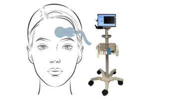 Crainio set-up for brain monitoring