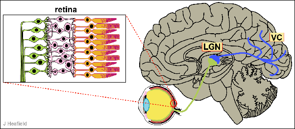 Embrace Autism | Heightened sensory perceptions | main qimg 2aec8af6d05d3ab50556d391f66b390c