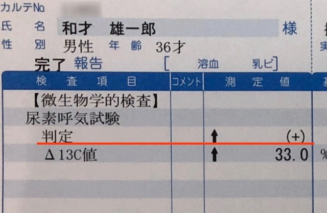 【胃がんの原因】ピロリ菌の一次除菌（成功確率92.6％）に失敗した結果…