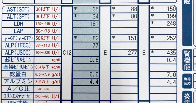 血液検査の結果を見た医者の一言にゾッとした / もしもポールダンスを続けていなかったら今頃……