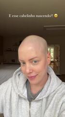 Fabiana Justus mostra crescimento do cabelo em meio a tratamento de câncer