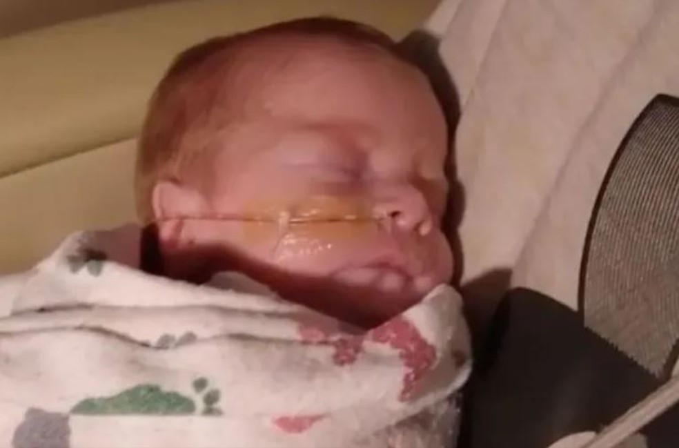 Kash, o filho de Peyton Stover e de Travis Koesters, nasceu prematuro, pesando cerca de 1,8 quilos — Foto: Reprodução/KETV