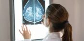 NHS to allow women with cancer symptoms to self-refer to breast clinics