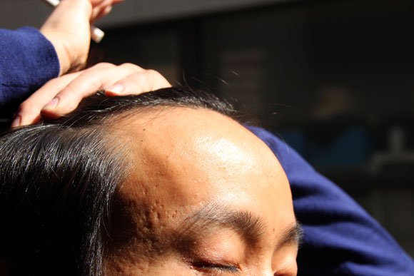 Tokyo pub offers “balding discount” for follicly-challenged diners