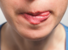 5 reasons for chapped lips other than cold weather