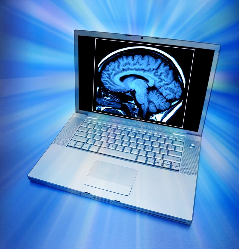Brain Scan Computer Health royalty free stock photography
