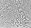 Polytene chromosomes