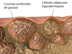 Cellulite.svg