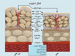 Formation of Cellulite-ar.jpg