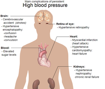 Complications of hypertension whitebackground.png