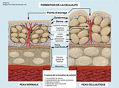 Formation of Cellulite-fr.jpg