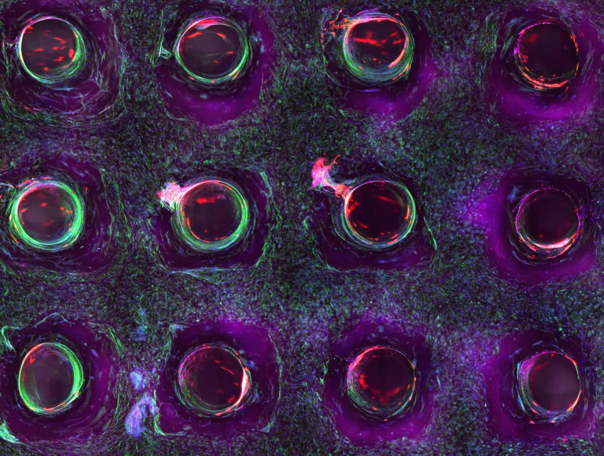 Bioprinting device