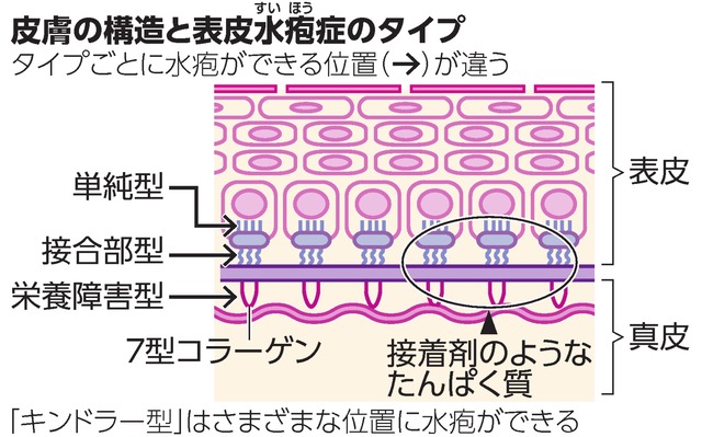 写真・図版