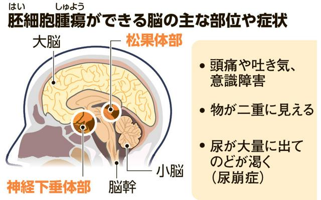 写真・図版