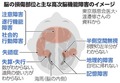 写真・図版