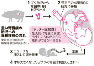 写真・図版