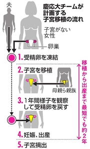 写真・図版