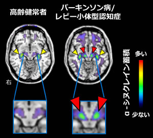 写真・図版