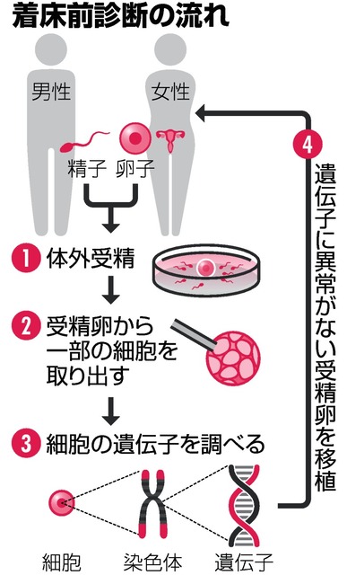 写真・図版