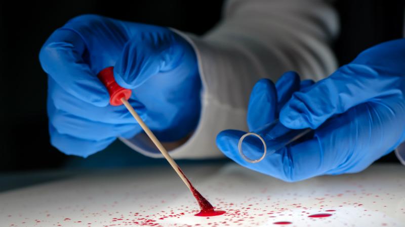 Crime scene-investigation blood swab test