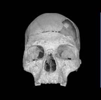 Homo sapiens skull