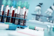 Blood testing capacity issues slow down leukaemia referrals, say GPs