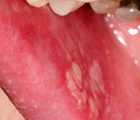 Key questions on oral medicine (1.5 CPD hours)