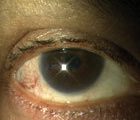 Ocular disorders – Key questions (1.5 CPD hours)