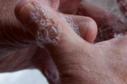 Web programme on handwashing cut spread of flu and number of GP visits