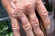 NICE urges rheumatoid arthritis patients to seek specialist care during flare-ups