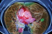 GP trial starts for ‘one-stop-shop’ cancer diagnostics