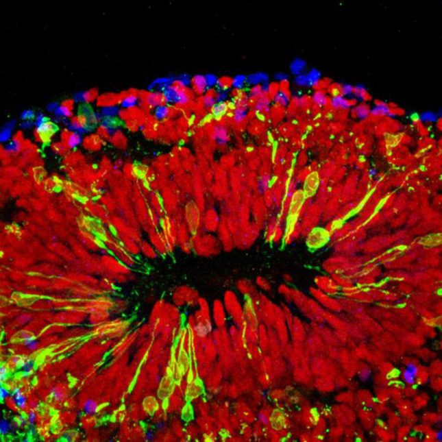 Brain Organoid Hopkins