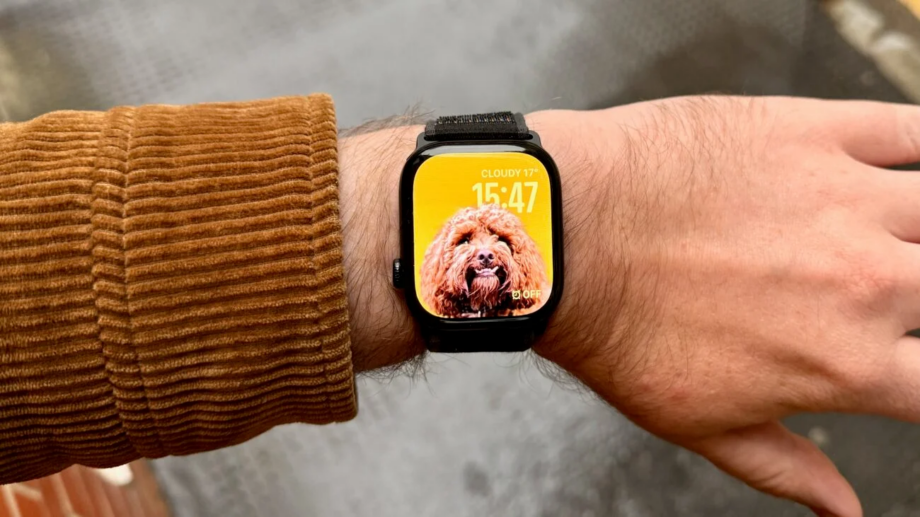 Apple Watch Series 10